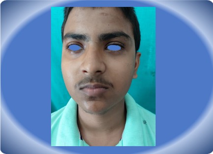 MAXILLOFACIAL INJURY